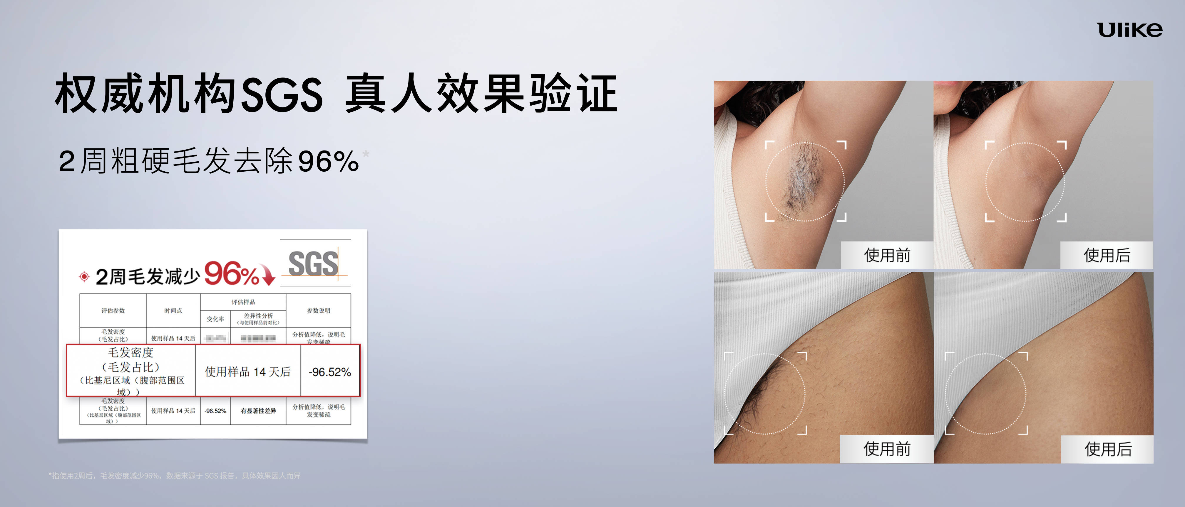 全球销量第一的脱毛仪品牌Ulike发布超级脱毛技术 或将实现永久脱毛 