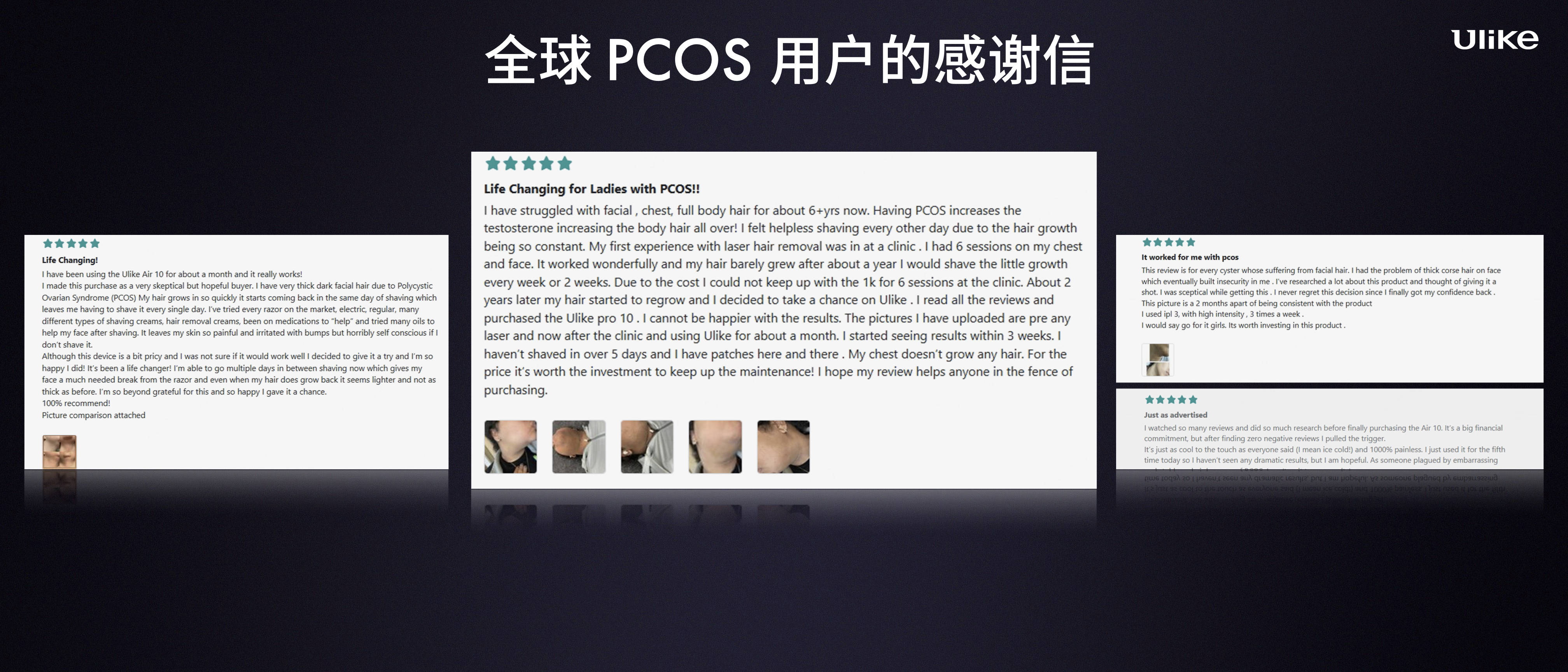 全球销量第一的脱毛仪品牌Ulike发布超级脱毛技术 或将实现永久脱毛 