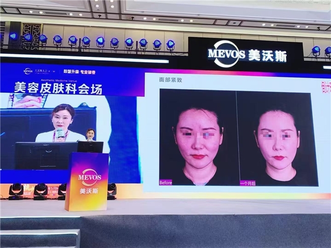 “仿生肽巨头”：Caregen子品牌德玛莉的千亿抗衰野望