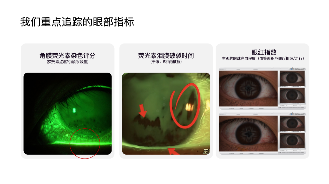 OPPO 联手视觉健康全国重点实验室，为屏幕护眼引入医学级标准