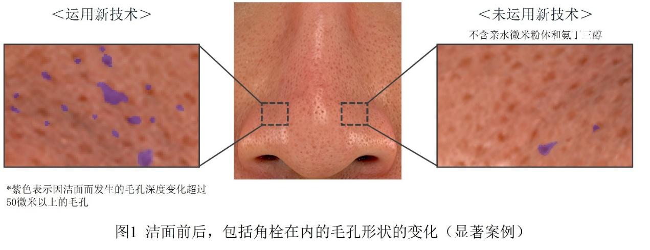 花王开发全新皮肤清洁技术 以亲水微米级粉体配合基于氨丁三醇的“角栓崩解清洁技术” 可以清除毛孔深处角栓,并可使黑头污垢淡化